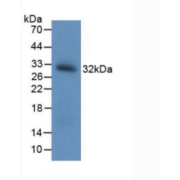 Brain Derived Neurotrophic Factor (BDNF) Human, Mouse, Rat, Rabbit, Pig, Capra hircus; Caprine (Goat), Equus caballus; Equine (Horse) Polyclonal Antibody