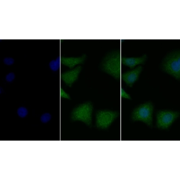 Brain Derived Neurotrophic Factor (BDNF) Mouse Polyclonal Antibody