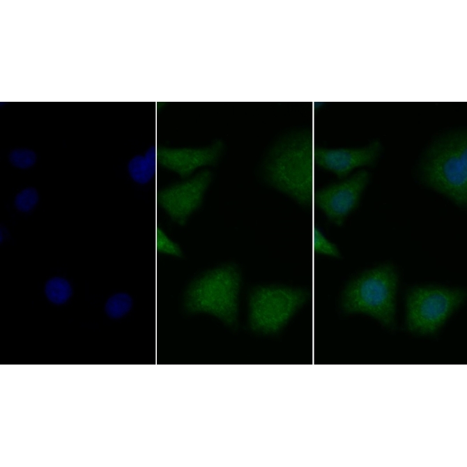 Brain Derived Neurotrophic Factor (BDNF) Mouse Polyclonal Antibody