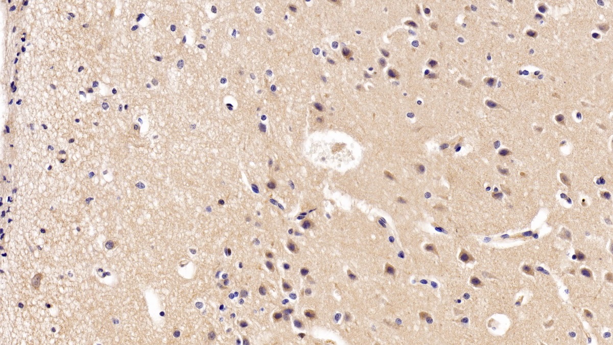 Brain Derived Neurotrophic Factor (BDNF) Pig Polyclonal Antibody