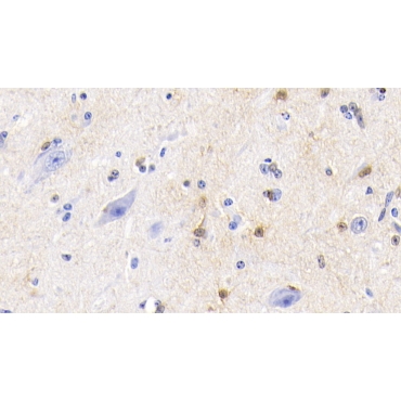 S100 Calcium Binding Protein (S100) Bovine (Cattle) Polyclonal Antibody