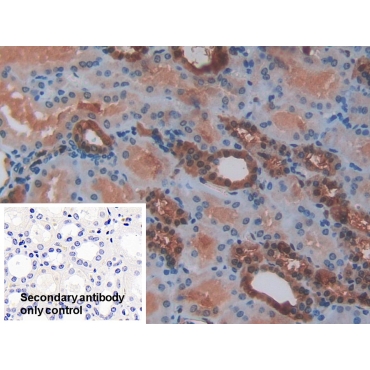 S100 Calcium Binding Protein (S100) Human Polyclonal Antibody