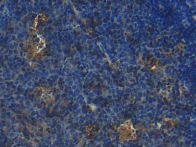 S100 Calcium Binding Protein (S100) Mouse Polyclonal Antibody