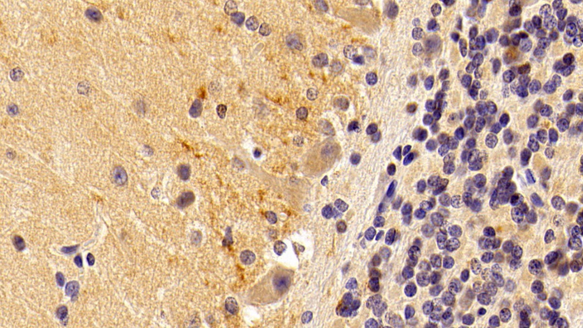 Bone Morphogenetic Protein 2 (BMP2) Rabbit Polyclonal Antibody