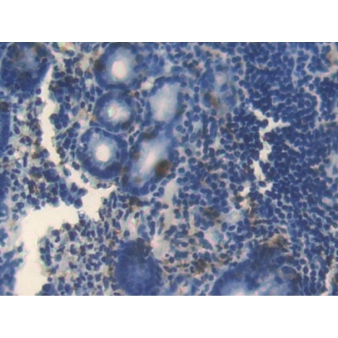 Bone Morphogenetic Protein 4 (BMP4) Human Polyclonal Antibody