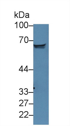 Bone Morphogenetic Protein Receptor 1A (BMPR1A) Rat Polyclonal Antibody