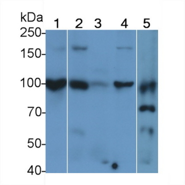 E-cadherin Human Polyclonal Antibody