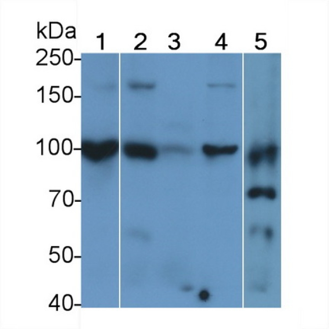 E-cadherin Human Polyclonal Antibody