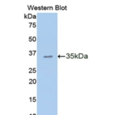 E-cadherin Human Polyclonal Antibody