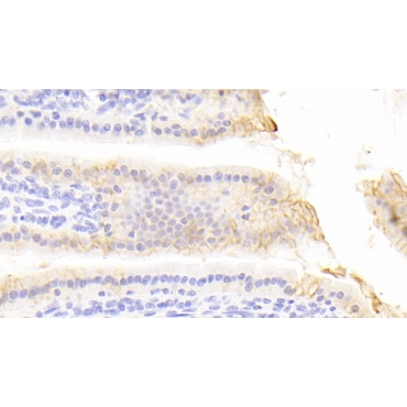 E-cadherin Mouse Polyclonal Antibody