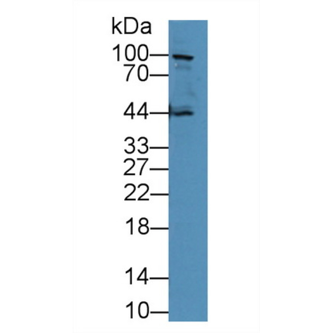 E-cadherin Mouse Polyclonal Antibody