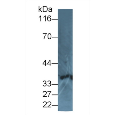 Interleukin 8 Receptor Alpha (IL8Ra) Human Polyclonal Antibody