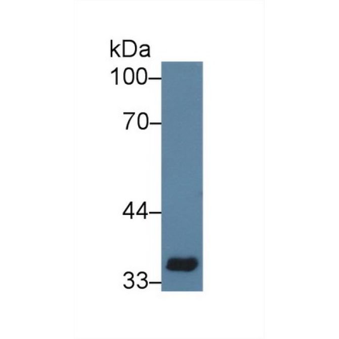 Cluster Of Differentiation 33 (CD33) Mouse Polyclonal Antibody