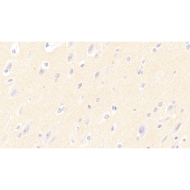 Ciliary Neurotrophic Factor (CNTF) Human Polyclonal Antibody