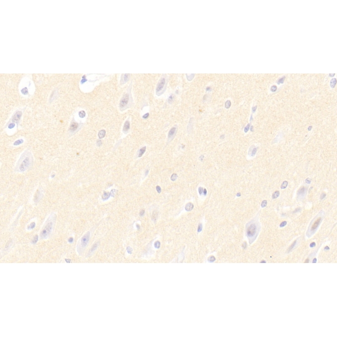 Ciliary Neurotrophic Factor (CNTF) Human Polyclonal Antibody