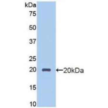 Endothelial protein C receptor (EPCR) Human Polyclonal Antibody