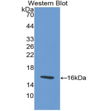 Endocrine Gland Derived Vascular Endothelial Growth Factor (EG-VEGF) Human Polyclonal Antibody