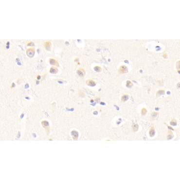 Erythropoietin Receptor (EPOR) Human Polyclonal Antibody