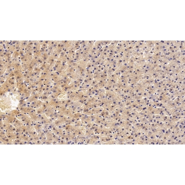 Erythropoietin Receptor (EPOR) Human Polyclonal Antibody