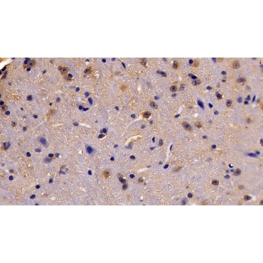Erythropoietin Receptor (EPOR) Mouse Polyclonal Antibody