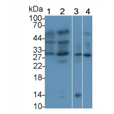 Erythropoietin (EPO) Human Polyclonal Antibody