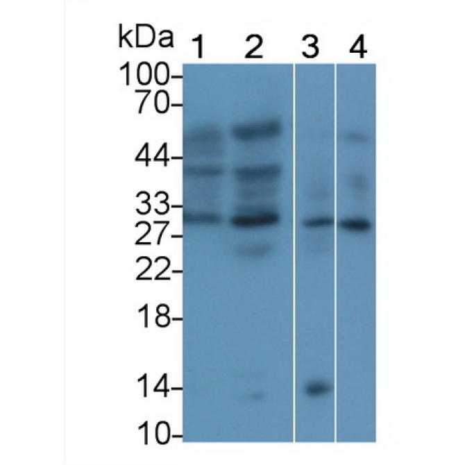 Erythropoietin (EPO) Human Polyclonal Antibody