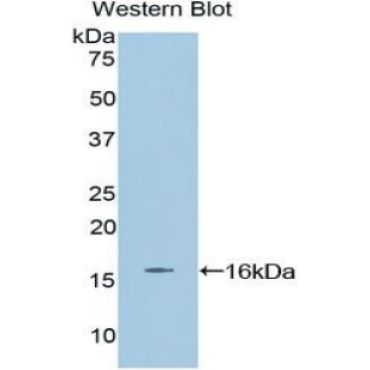 Erythropoietin (EPO) Mouse Polyclonal Antibody