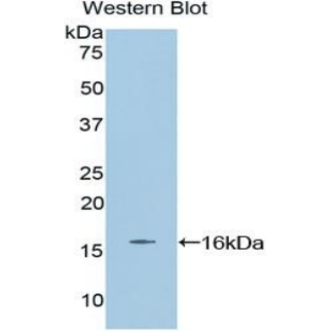 Erythropoietin (EPO) Mouse Polyclonal Antibody