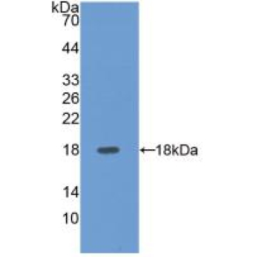 E-selectin Human Polyclonal Antibody