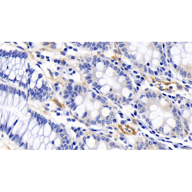 Factor Related Apoptosis (FAS) Human Polyclonal Antibody