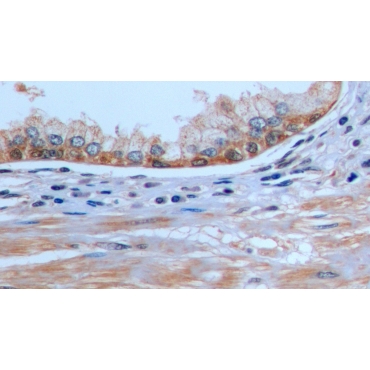 Factor Related Apoptosis (FAS) Human Polyclonal Antibody