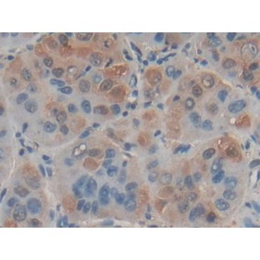Factor Related Apoptosis Ligand (FASL) Human Polyclonal Antibody