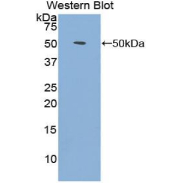 Fibroblast Growth Factor 1, Acidic (FGF1) Human Polyclonal Antibody