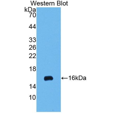 Interferon Alpha (IFNa) Bovine (Cattle) Polyclonal Antibody