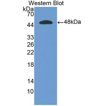 Interferon Alpha (IFNa) Human Polyclonal Antibody