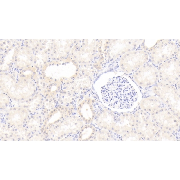Interferon Alpha (IFNa) Human Polyclonal Antibody