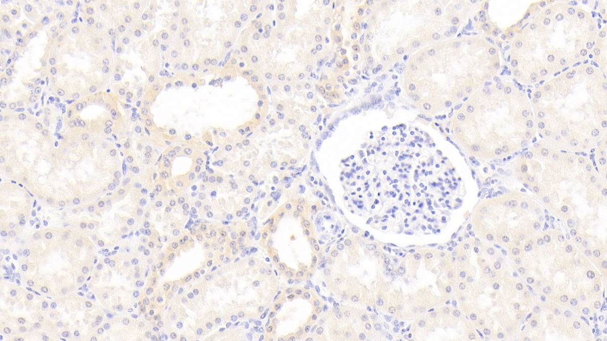 Interferon Alpha (IFNa) Human Polyclonal Antibody