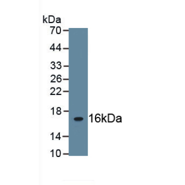 Fibronectin (FN) Bovine (Cattle) Polyclonal Antibody