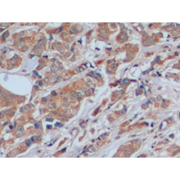 Fibronectin (FN) Human Polyclonal Antibody