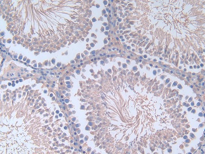 Fibronectin (FN) Rat Polyclonal Antibody