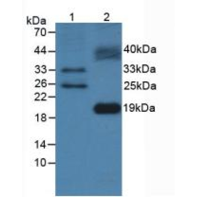 FMS Like Tyrosine Kinase 3 Ligand (Flt3L) Mouse Polyclonal Antibody