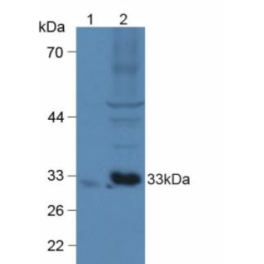 Chemokine C-X3-C-Motif Ligand 1 (CX3CL1) Human Polyclonal Antibody