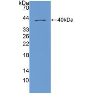 Chemokine (C-X-C Motif) Ligand 1 (CXCL1) Human Polyclonal Antibody