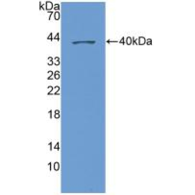 Chemokine (C-X-C Motif) Ligand 1 (CXCL1) Human Polyclonal Antibody
