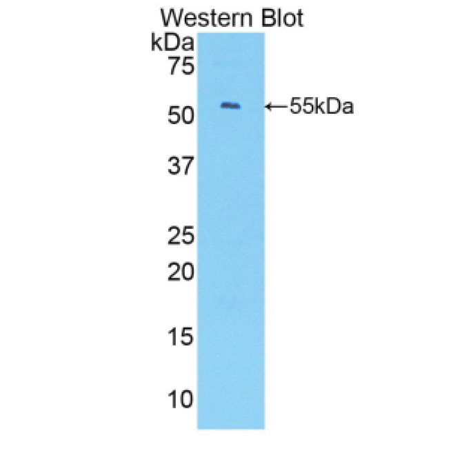 Chemokine (C-X-C Motif) Ligand 1 (CXCL1) Mouse Polyclonal Antibody