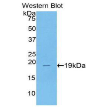 Colony Stimulating Factor 3, Granulocyte (GCSF) Human Polyclonal Antibody