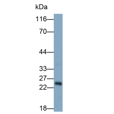 Glial Cell Line Derived Neurotrophic Factor (GDNF) Human Polyclonal Antibody