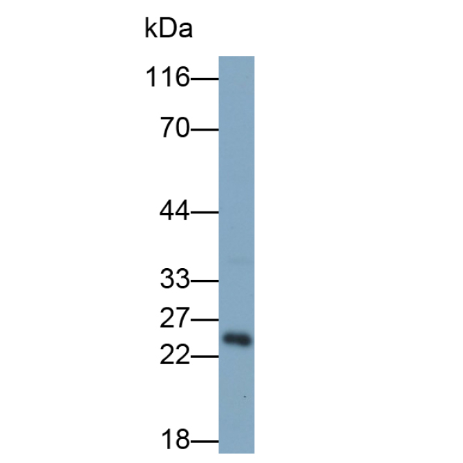 Glial Cell Line Derived Neurotrophic Factor (GDNF) Human Polyclonal Antibody