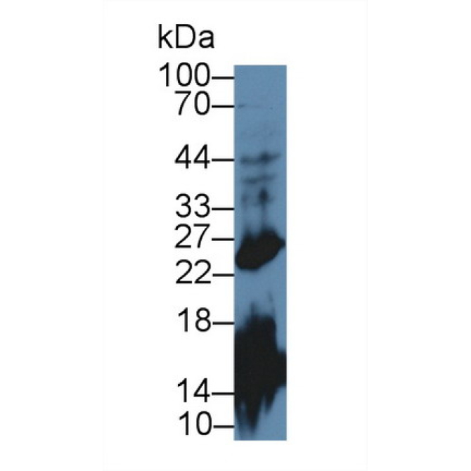 Growth Hormone (GH) Mouse Polyclonal Antibody