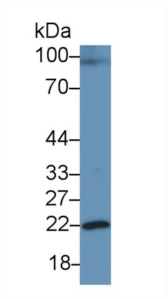Growth Hormone (GH) Rat Polyclonal Antibody